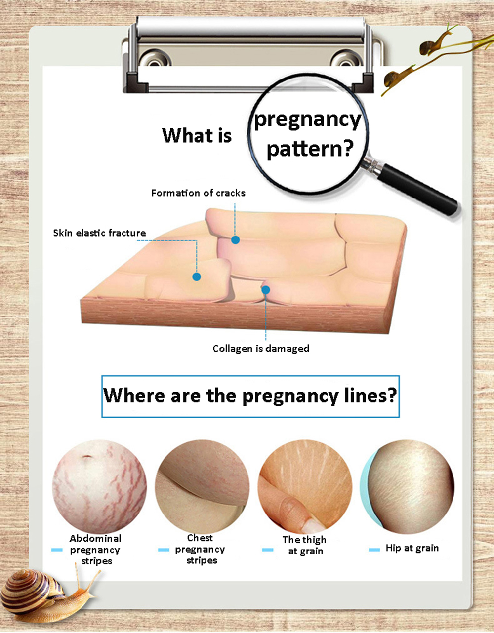 Stretch Marks Remover Essential Oil Skin Care Treatment Cream For Stretch Mark Removal Maternity Slackline For Pregnant Oils