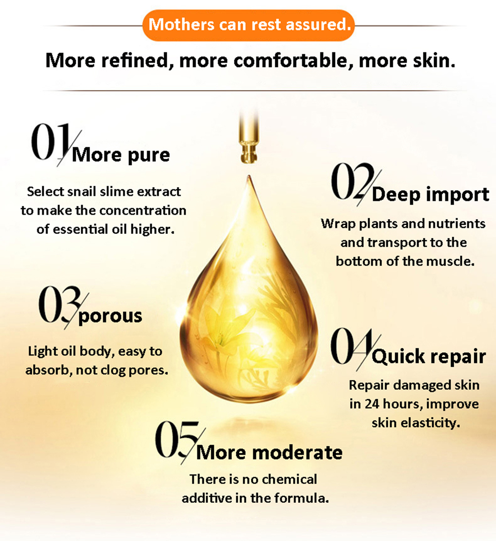 Stretch Marks Remover Essential Oil Skin Care Treatment Cream For Stretch Mark Removal Maternity Slackline For Pregnant Oils