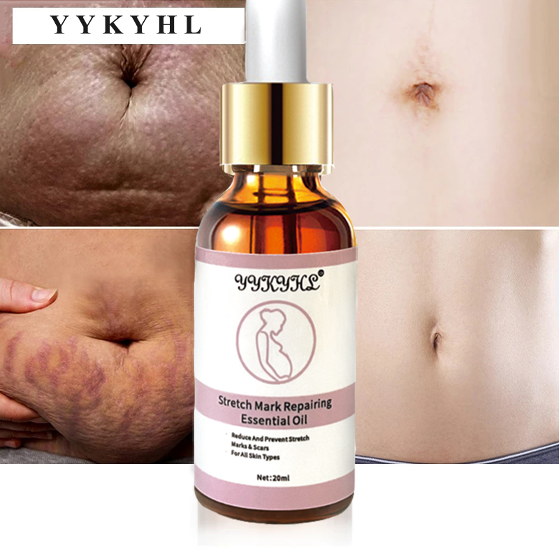 Stretch Marks Remover Essential Oil Skin Care Treatment Cream For Stretch Mark Removal Maternity Slackline For Pregnant Oils
