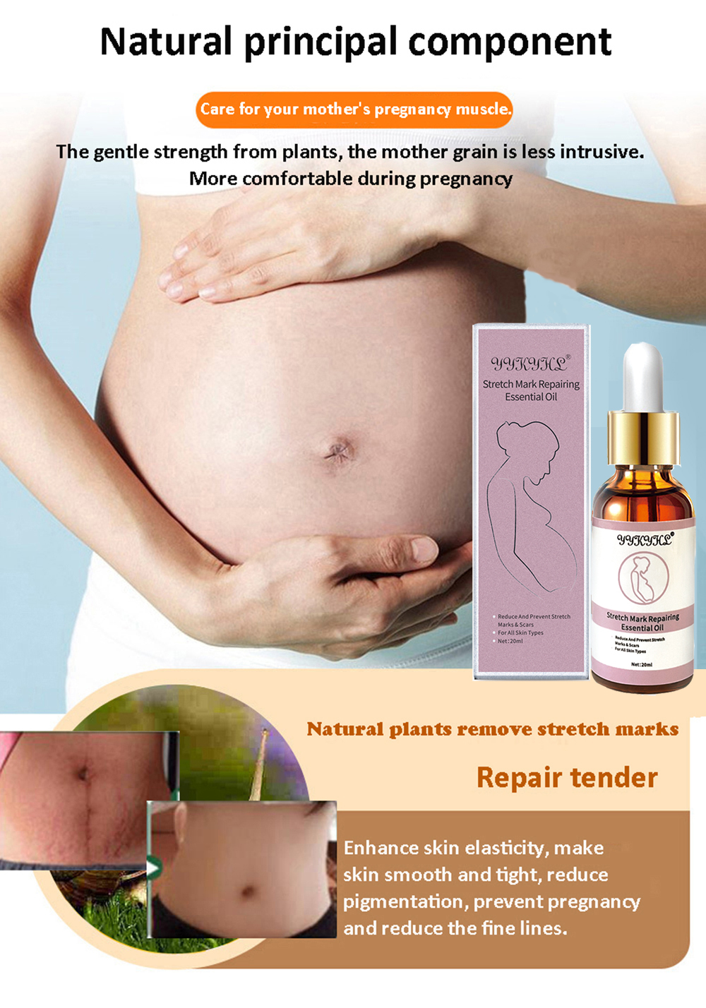 Stretch Marks Remover Essential Oil Skin Care Treatment Cream For Stretch Mark Removal Maternity Slackline For Pregnant Oils
