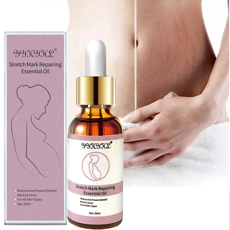 Stretch Marks Remover Essential Oil Skin Care Treatment Cream For Stretch Mark Removal Maternity Slackline For Pregnant Oils