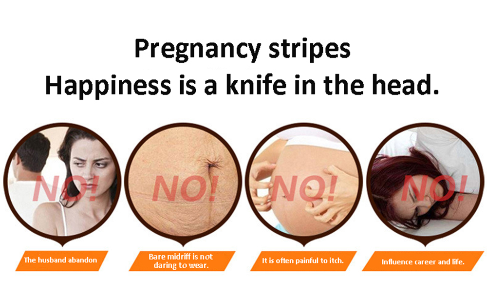 Stretch Marks Remover Essential Oil Skin Care Treatment Cream For Stretch Mark Removal Maternity Slackline For Pregnant Oils